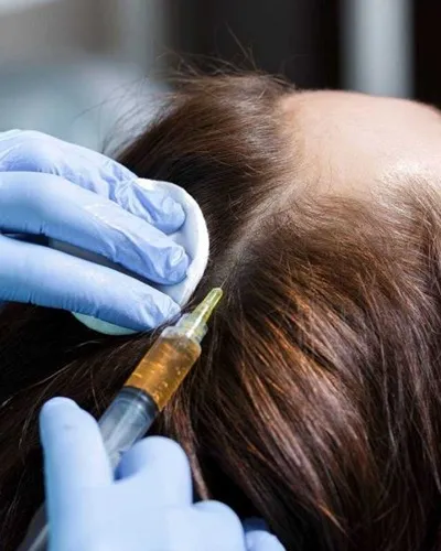 Stimulation therapy for Hair fall being done at Dermys Clinic Nagpur